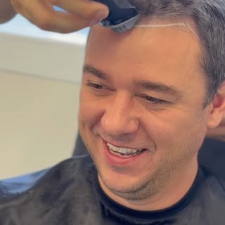 O @diariodocarroeletrico escolheu a Kpilare em São Paulo para realizar o transplante capilar FUE e c