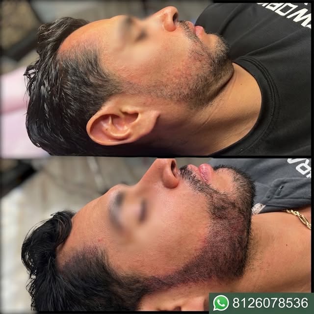 ¿Barba incompleta o con huecos? Logra una apariencia de mayor densidad y definición con nuestra técn