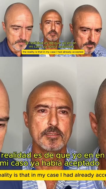 La pérdida de cabello puede comenzar en diferentes edades y la micropigmentación capilar puede ser u