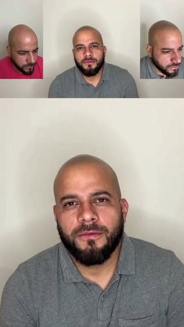 Antes y después! Que te pareció el resultado? 

Realizamos una línea difusa con acabado natural. 

#
