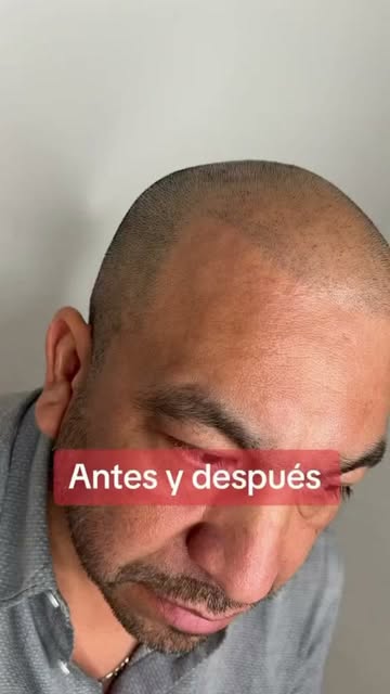 Un cambio que no puedes ignorar! 
¡Agenda tu valoración hoy mismo y descubre el cambio! 👇
📲 Solici