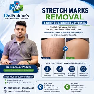 ✨ **Say Goodbye to Stretch Marks with Advanced Treatment!** ✨

Are stretch marks affecting your conf