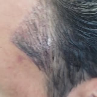 No shave. No compromise.
Frontal line densified. Temporal peaks redesigned for structure and balance