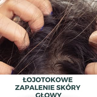 Czy czujesz swędzenie lub pieczenie skóry głowy, a dodatkowo - obserwujesz jej łuszczenie się?😢

To