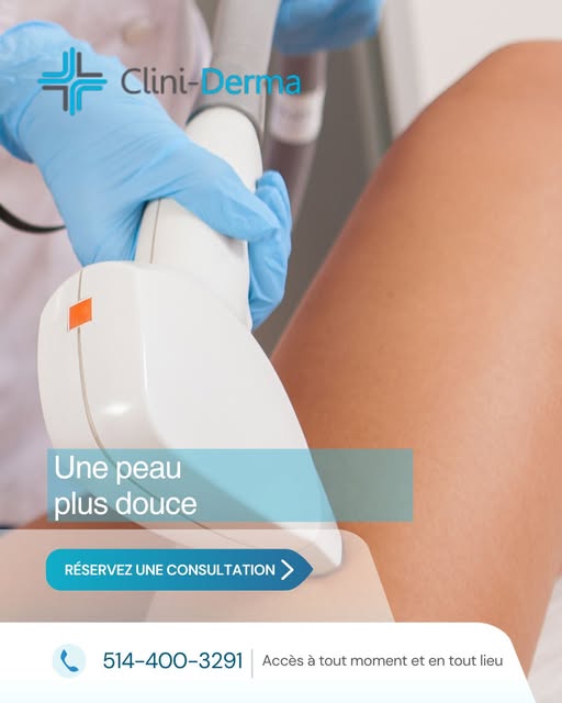 L’épilation au laser cible la mélanine du poil afin de chauffer et d’affaiblir le follicule, réduisa