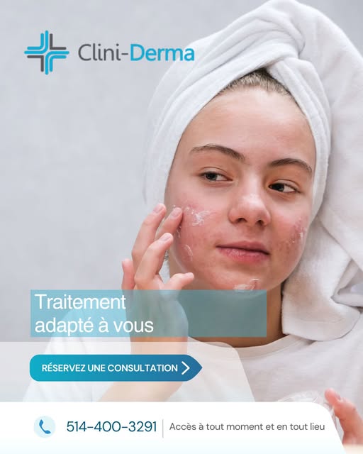 Pour l’acné légère à modérée, les traitements topiques, tels que les crèmes et les vaporisateurs, pe