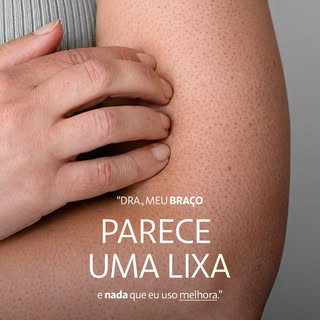 Se você sente que a pele dos braços ou das pernas está sempre áspera e com pequenas bolinhas, saiba 