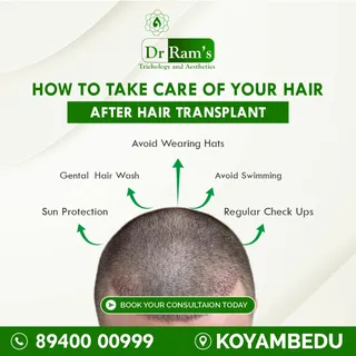 ✨ Nailed Your Hair Transplant? Here’s How to Keep It Perfect ✨

💆‍♂️ Post-transplant care is key to