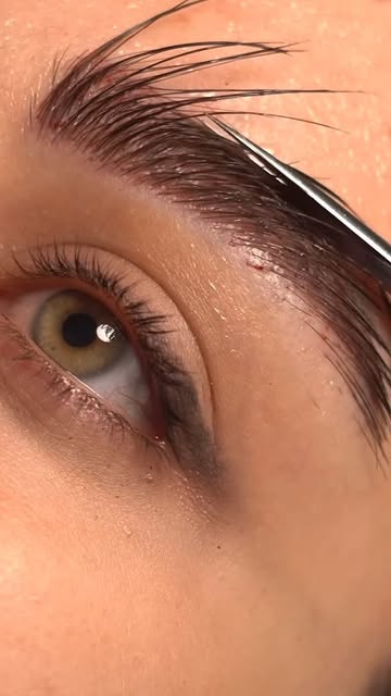 ✨ Did you know? After an eyebrow transplant, the new eyebrow hair actually grows just like the hair 