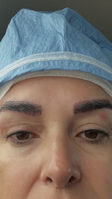 The secret to great eyebrows isn’t makeup. It’s having the right eyebrows.

Our eyebrow transplant p