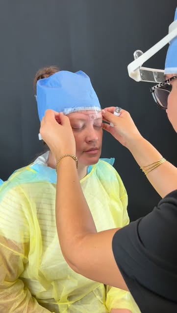 Natural-looking eyebrow restoration begins long before the first graft is placed.

The white mapping
