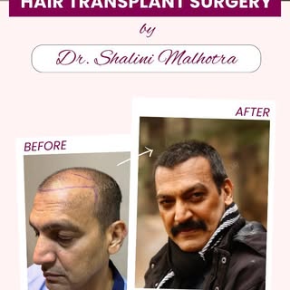 You must have seen Mr. Manish Wadhwa playing different roles in movies and TV shows like Pathan, Gad