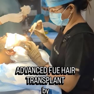 Dr Shalini Malhotra uses her signature  Advanced FUE technique of hair transplant using Implanters t