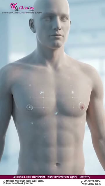 Understanding Gynecomastia: What you need to know! 💡

Gynecomastia male chest tissue mein enlargeme