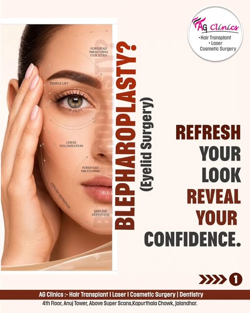 ✨ Refresh Your Look, Reveal Your Confidence!

 ✨Wondering how Blepharoplasty (Eyelid Surgery) can tr