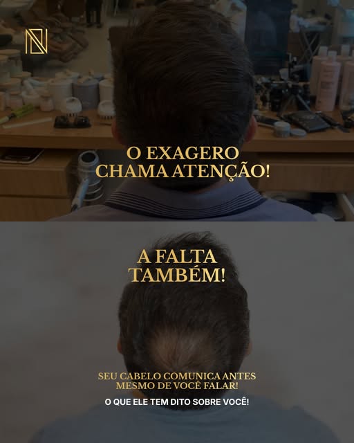 Nem sempre a calvície começa de forma evidente. 

Muitas vezes, os primeiros sinais aparecem aos pou