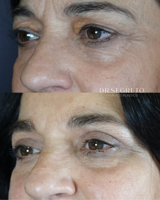 Hai mai pensato che il tuo sguardo possa farti sembrare più stanco di quanto sei davvero?

Spesso il