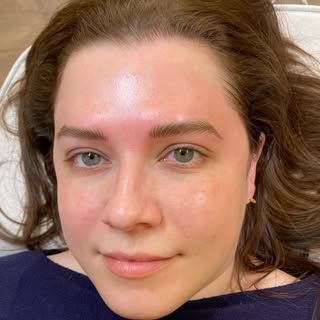 After 8 years ( overdue)
She came back to get them refreshed with Nano Technique.
#nanobrows #victor