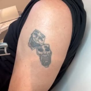 PicoSure Tattoo removal with Cooling machine. #tattooremoval #victoriabccanada🇨🇦 #picolaser #vanco