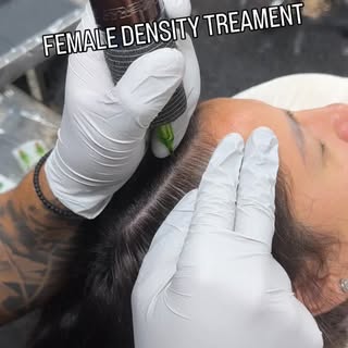 Restoring confidence, one session at a time.
Female density treatment using scalp micropigmentation 