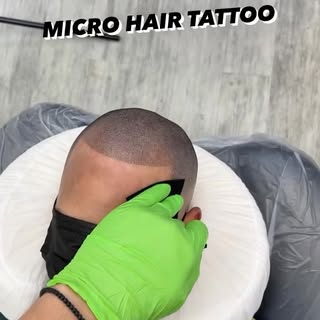 Your hair transplant was the first step... SMP is the game changer. 🔥
A hair transplant can restore