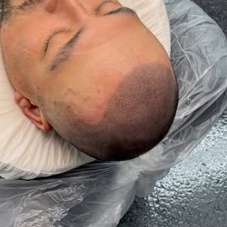 BEFORE AND AFTER SMP! 

Booking Sept & Oct Sessions. DM for a phone consultation ℹ️ 
.
.
.
.
.
.
.
#