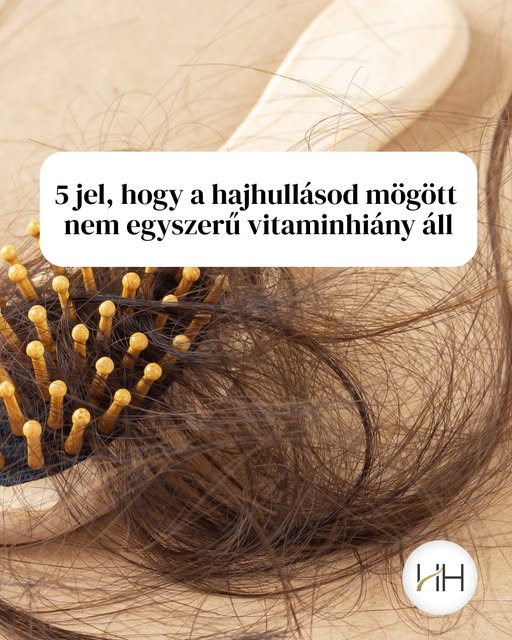 Hullik a hajad, ezért rögtön vitaminhiányra gondolsz? 🤔 

Nem biztos, hogy ennyire egyszerű a helyz