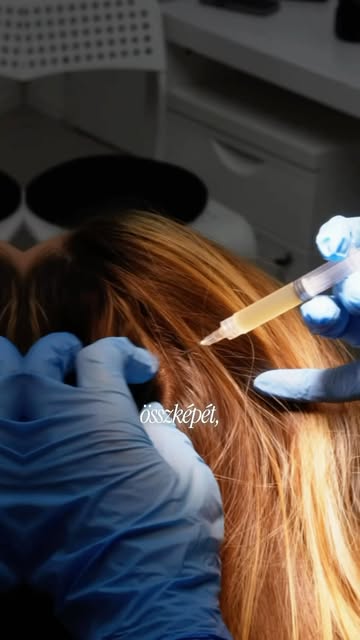 ✨ I-PRF terápia – természetes regeneráció a saját véred erejével.

Az I-PRF saját vérből készülő reg