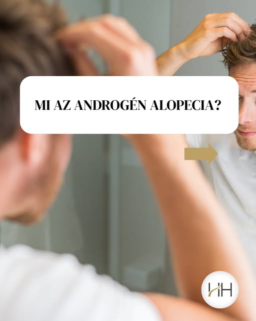 A hajad fokozatosan elvékonyodik, ritkul, vagy egyre szélesebbnek tűnik a választékod? 👀 Ennek hátt