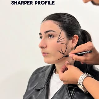 Every placement has a purpose. 

By treating the right areas, we can enhance your natural features, 