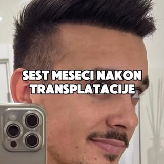 Za rezervaciju termina i više informacija kontaktirajte nas:
Whatsapp: 0090 552 386 2454
Viber : 009
