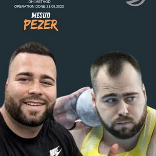 Kada poznata lica biraju - biraju provjereno !
Pravi rezultat, prirodna linija , snažniji izgled .
�