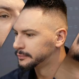 Rezultat koji privlači pažnju već na pola puta. 

Emir je trenutno u sredini svog procesa oporavka, 