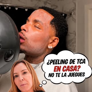 🚨 Un peeling de TCA no es un tratamiento para hacer en casa.

Aunque en redes sociales pueda parece