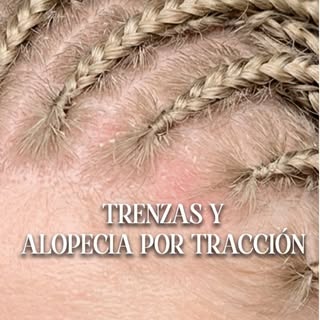 ☀️ Llega el verano, el sol, la playa… y esos puestos de trenzas en los paseos marítimos que parecen 