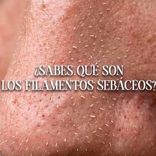 ✨ Esto no son puntos negros. Se llaman filamentos sebáceos y te enseño cómo solucionarlos.

Puedes u