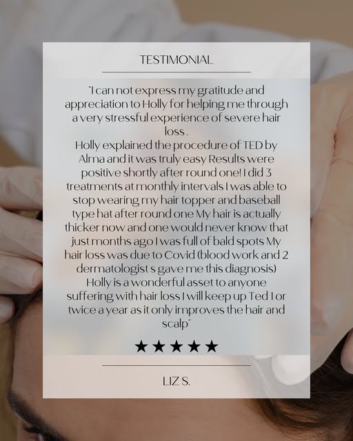 What if you could stop hiding your hair?

This client came to me after experiencing severe hair loss
