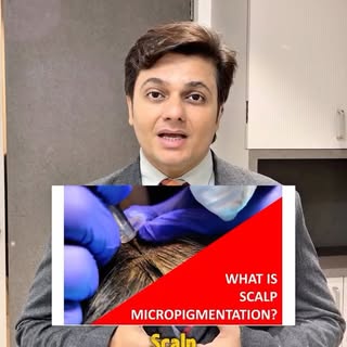 Scalp Micropigmentation (SMP) is a non-surgical solution designed to create the appearance of fuller