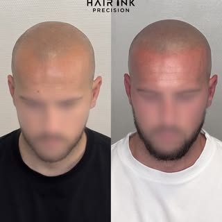 Une transformation discrète, naturelle et pensée dans les moindres détails.

Réalisation d’une trico