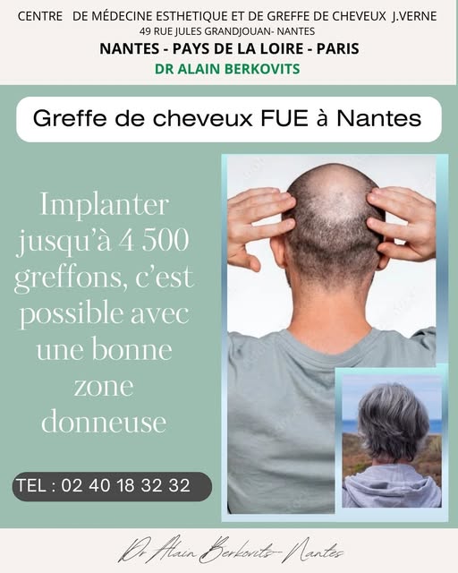 Dr Berkovits " La zone donneuse est un élément déterminant dans la réussite de la greffe de cheveux.