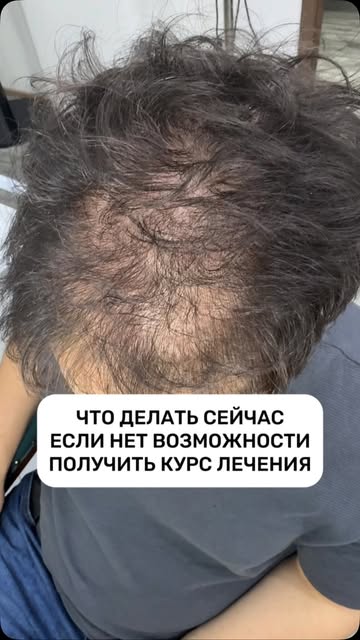 Что делать, если сейчас у вас нет возможности пройти наш курс против выпадения волос?

Начните с пра