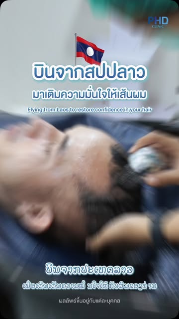 ✈️ บินตรงจาก สปป.ลาว 🇱🇦 สู่ PHD Clinic 🇹🇭

เคสนี้ลูกค้าบินตรงมาหาเราถึงประเทศไทย เพื่อเข้ารับการ