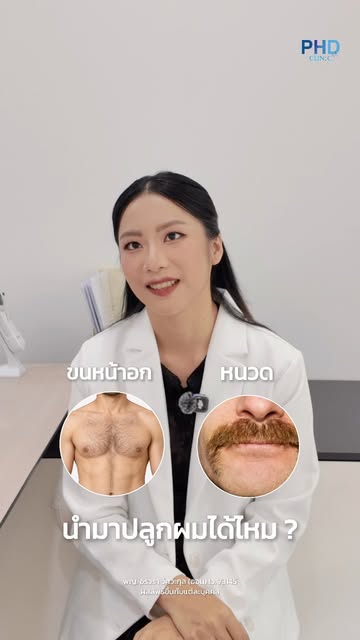 Did you know? Which body hair can be used for hair transplantation?

รู้ไหม? ขนบริเวณไหนสามารถนำมาปล