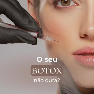 Como está a duração do seu botox?

A toxina botulínica, popularmente conhecida como Botox, é uma neu