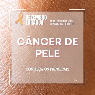 🧡 Dezembro Laranja: Cuide da Sua Pele, Proteja Sua Vida! 

O câncer de pele é o tipo mais comum de 