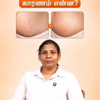 Stretch marks can develop due to pregnancy, rapid weight changes, hormonal changes and even heredita