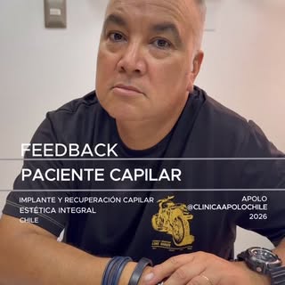 **Implante Capilar Exitoso en Clínica Apolo 💇‍♂️ | Testimonio Real**

Hoy compartimos un caso real 