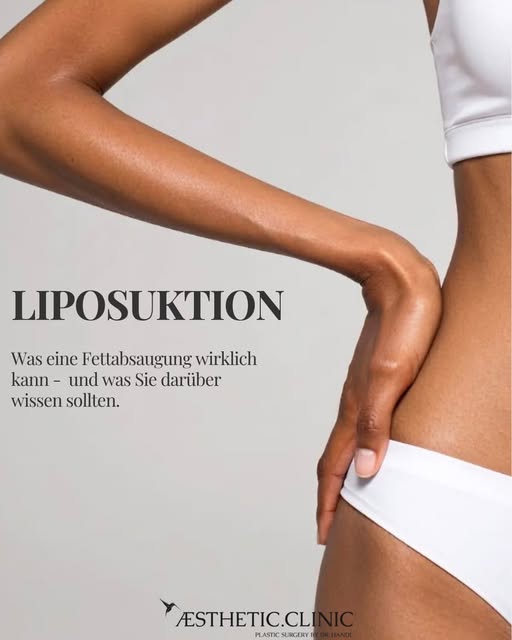 Trotz Sport und ausgewogener Ernährung können hartnäckige Fettdepots bestehen bleiben. Eine Liposukt