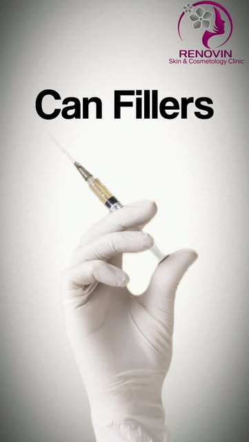 ✨ Quick Questions About Dermal Fillers — Answered! 💉✨

Thinking about fillers but have questions? F