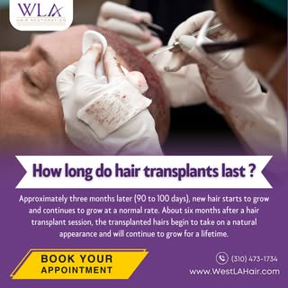 Hair transplants are designed to be a permanent solution to hair loss. 💆‍♂️ 
The transplanted hair 